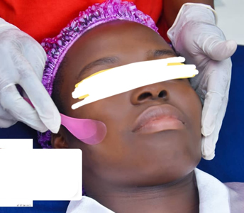 abidjan cote d ivoire soin du visage