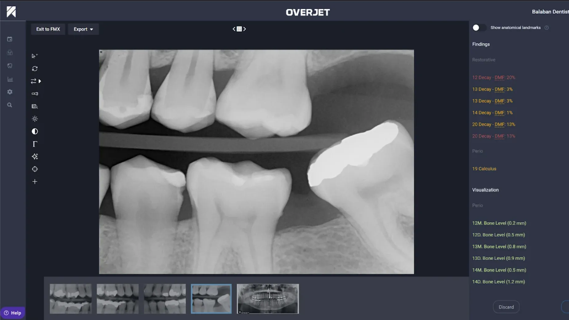IRIS AI-native dental imaging interface