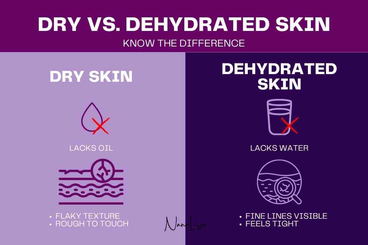 Dry vs. Dehydrated Skin Explained Infographic comparing dry and dehydrated skin, showing that dry skin lacks oil and feels rough, while dehydrated skin lacks water and feels tight.