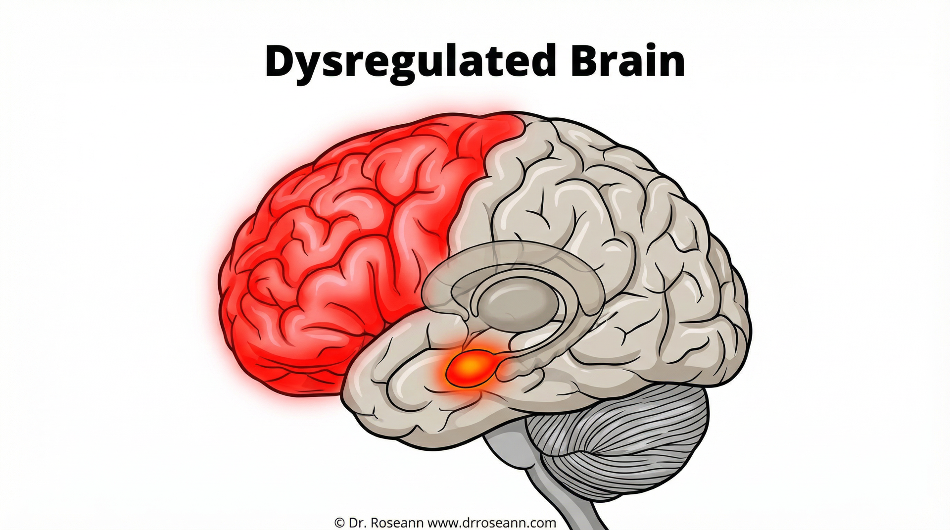 Simplified diagram of the brain's emotion centers - emotion dysregulation treatment