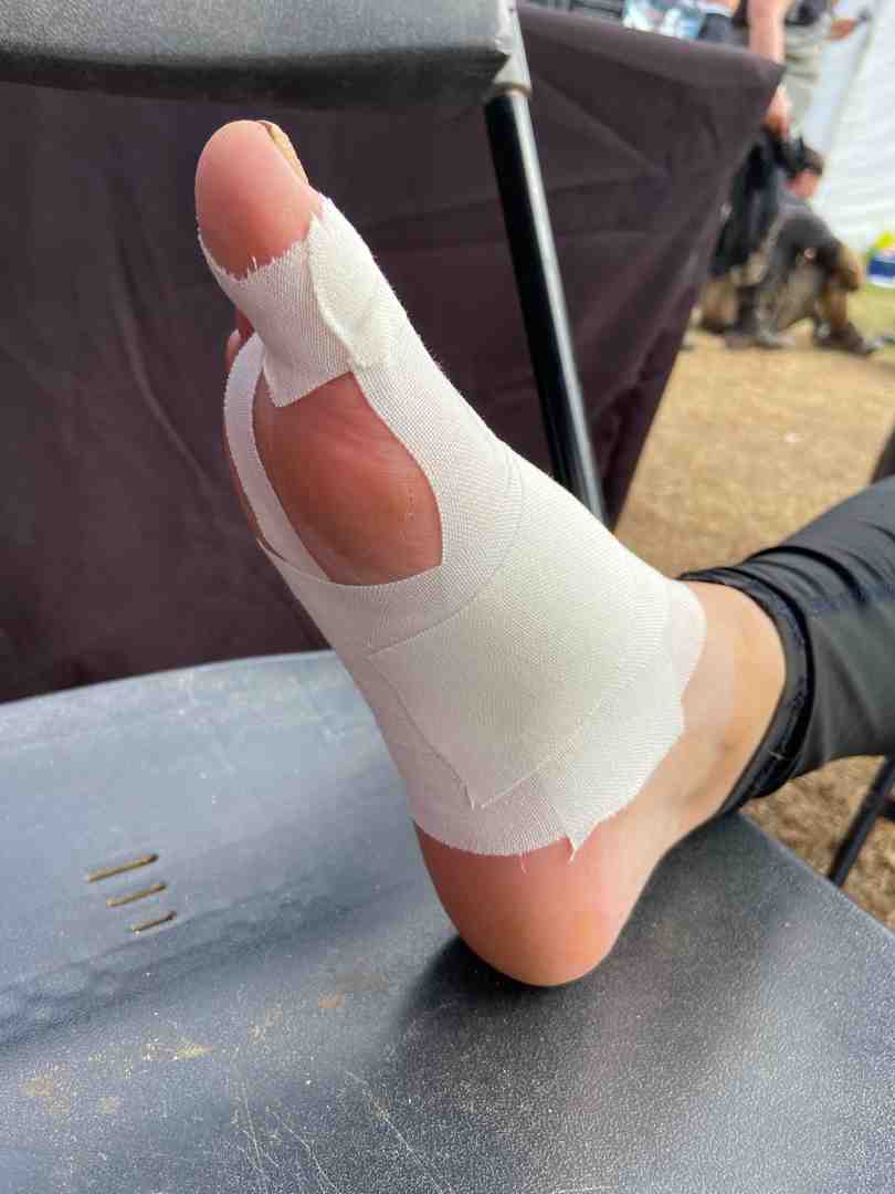 Demonstration of proper tape layout and application technique for turf toe, showing anchor placement and support strip positioning - taping turf toe for soccer