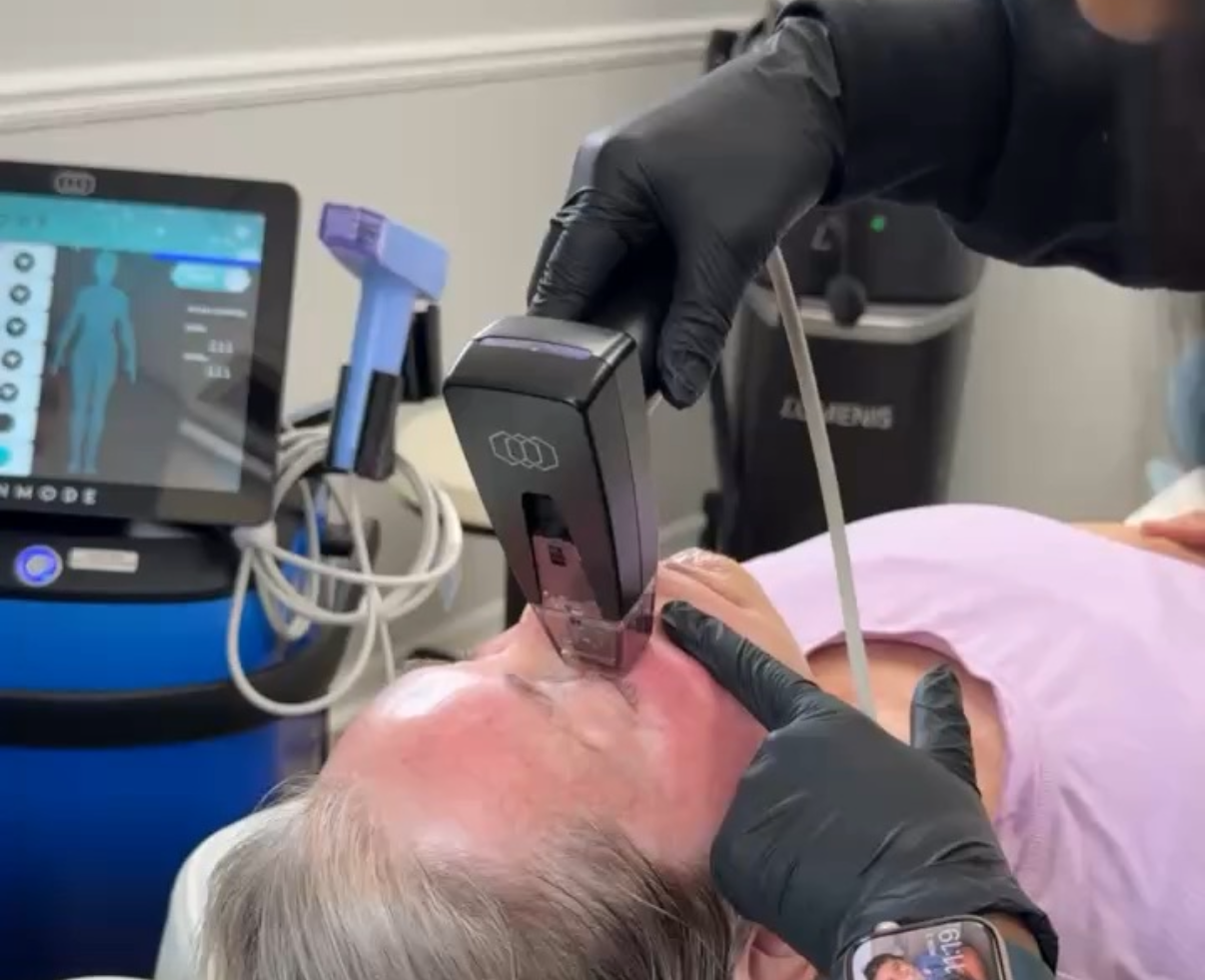 A serene treatment room at Aura Health & Spa with modern aesthetic equipment - morpheus skin tightening