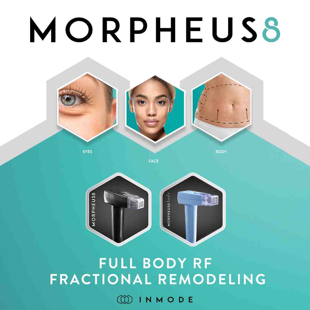 a face and body diagram showing different Morpheus8 treatment areas - morpheus skin treatment price