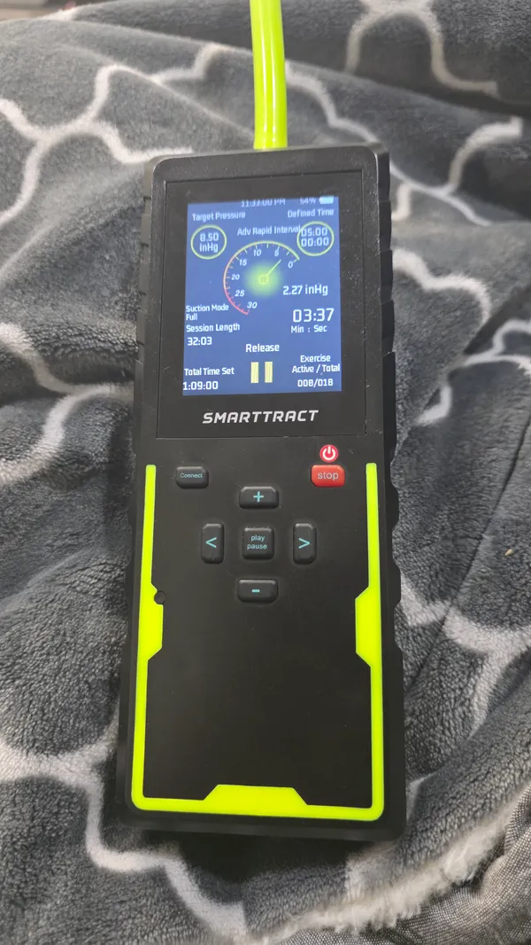 SmartTract Go Bundle