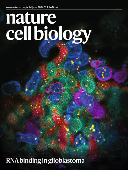 Integrative analysis of ultra-deep RNA-seq reveals activation of alternative promoters by oncogenic drivers and DNA hypomethylation during prostate tumor progression