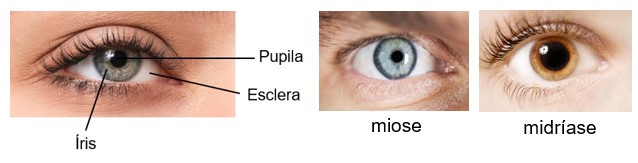 Íris, pupila normal, miose e midríase.