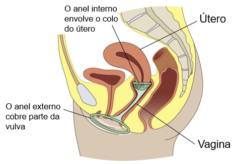 Camisinha feminina posicionada.