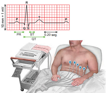 Eletrocardiograma (eletrodos e ondas).