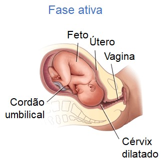 Estágio de dilatação: fase ativa.