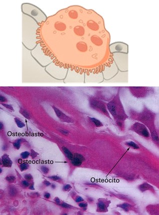 Osteoclastos.