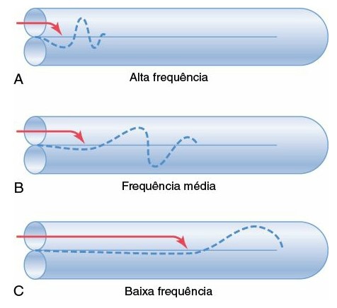 Propagação das ondas sonoras ao longo da membrana basilar.