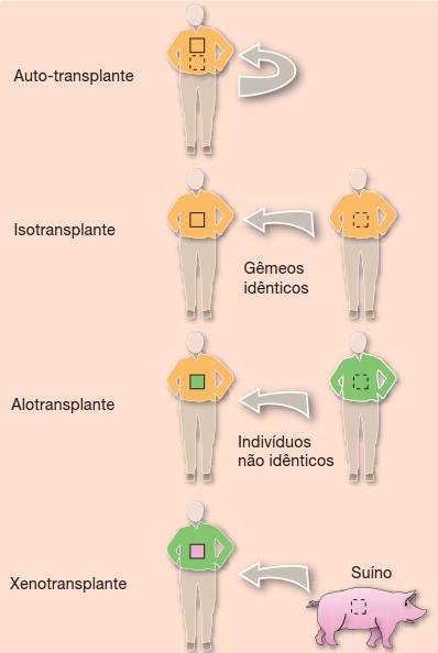 Tipos de transplantes.