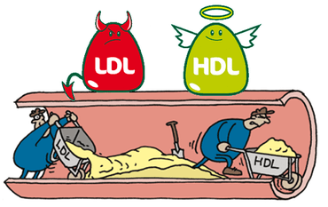 LDL e HDL na aterosclerose.