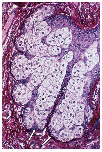 Glândula sebácea: acinosa (porção secretora arredondada).