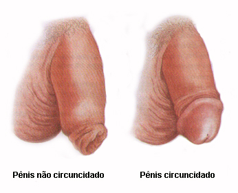 Circuncisão.
