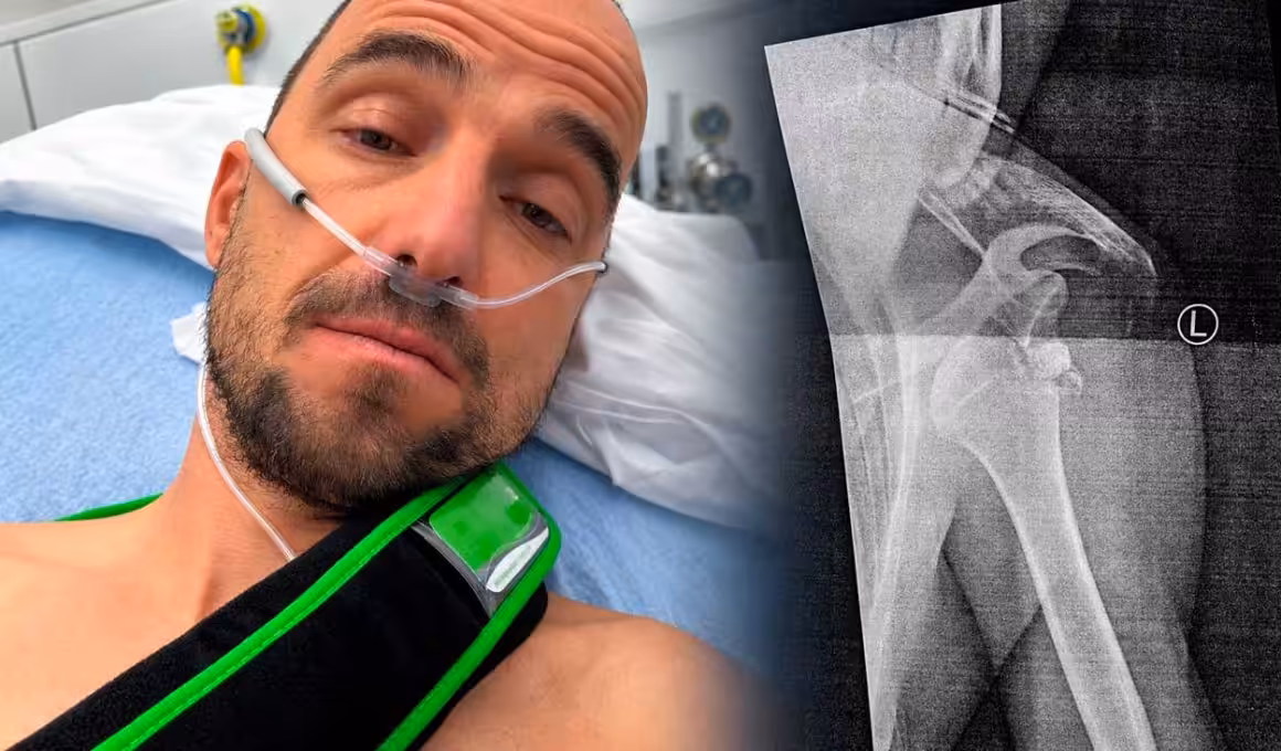 Nino Schurter sufre fractura de húmero y luxación de hombro en una caída con patinete de montaña