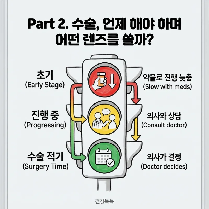 백내장 진행 단계별 치료 방법과 수술 적기 타이밍을 설명하는 신호등 도식