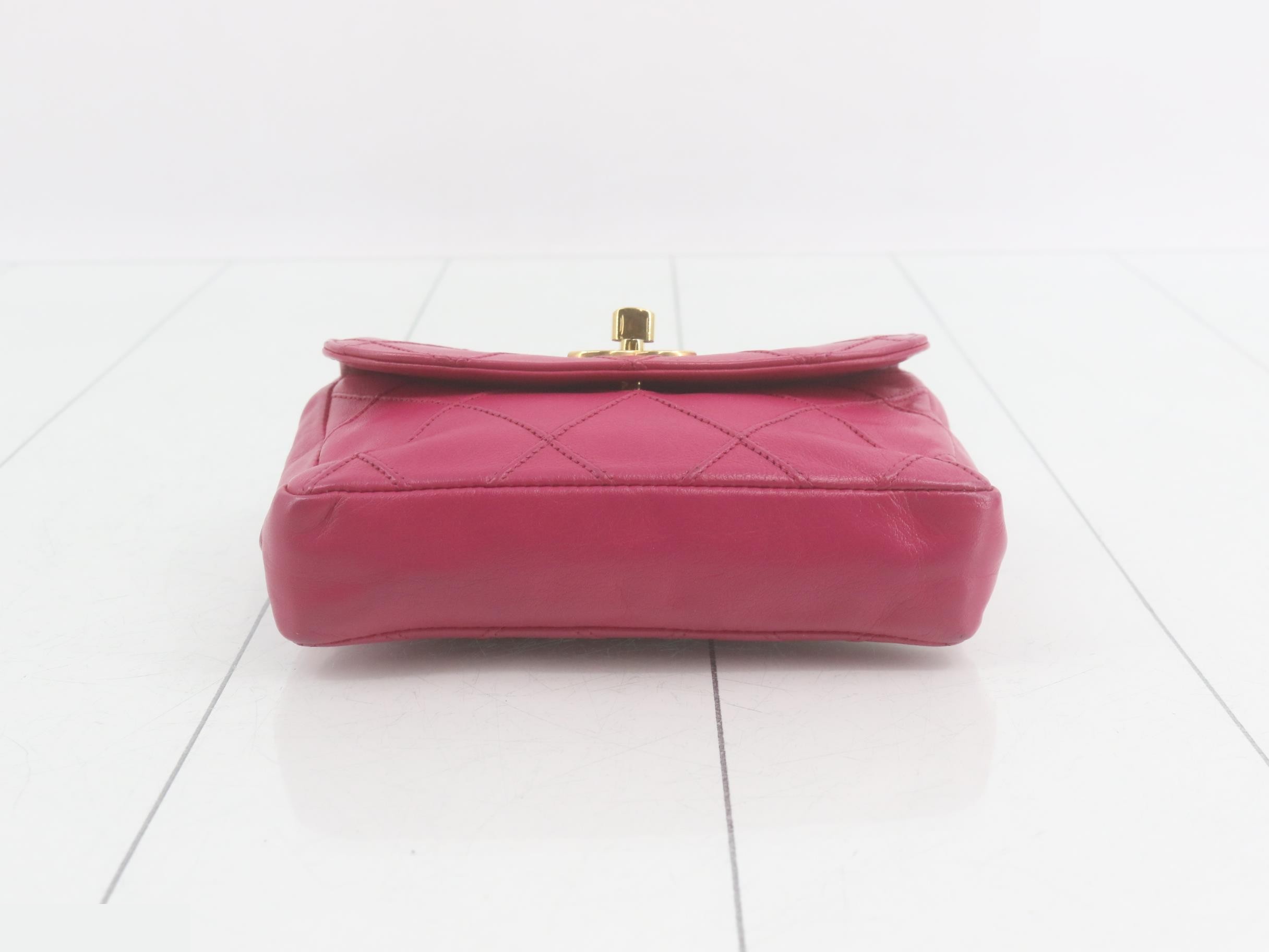 waist bag — view 3