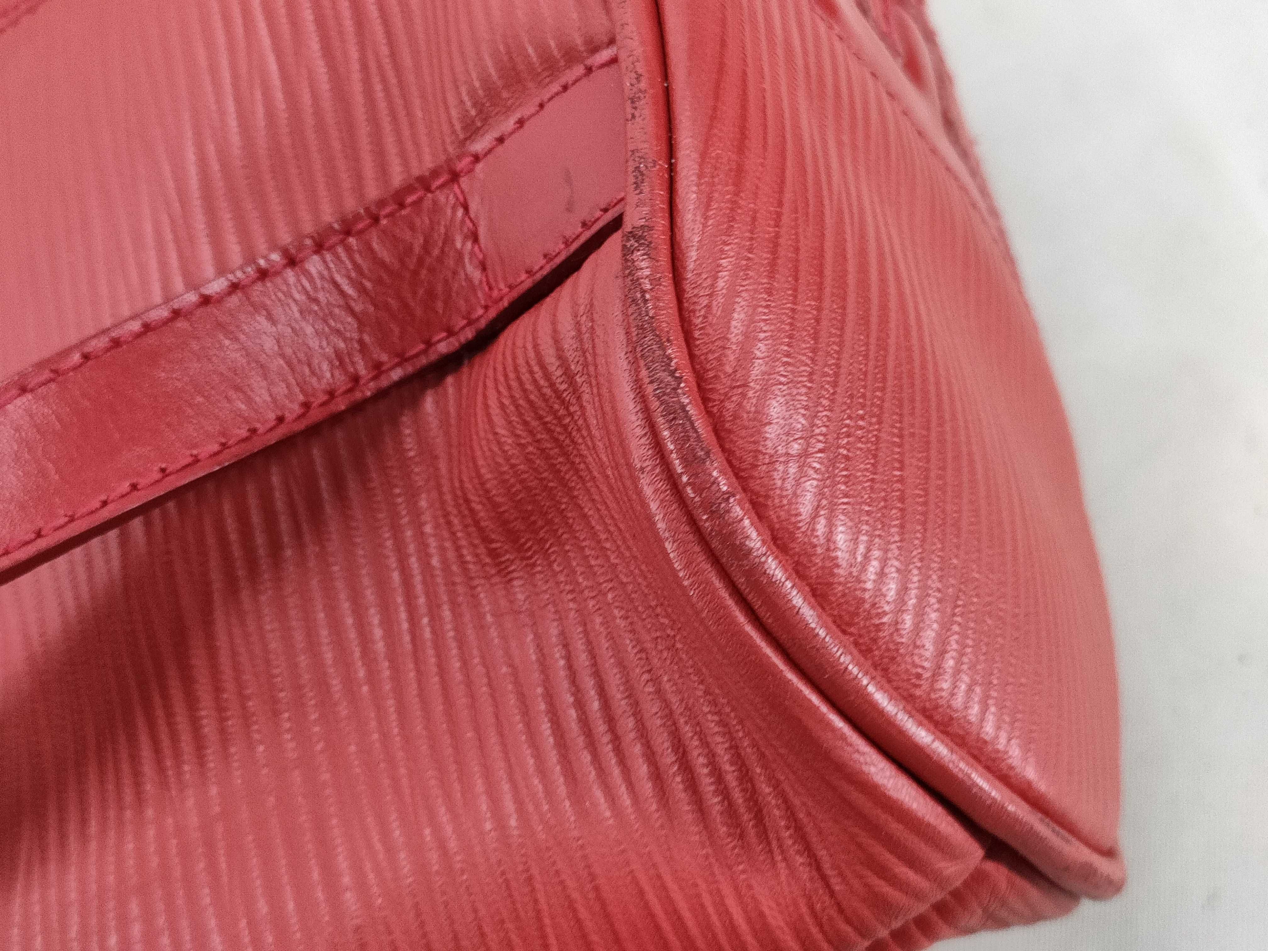 backpack — view 4