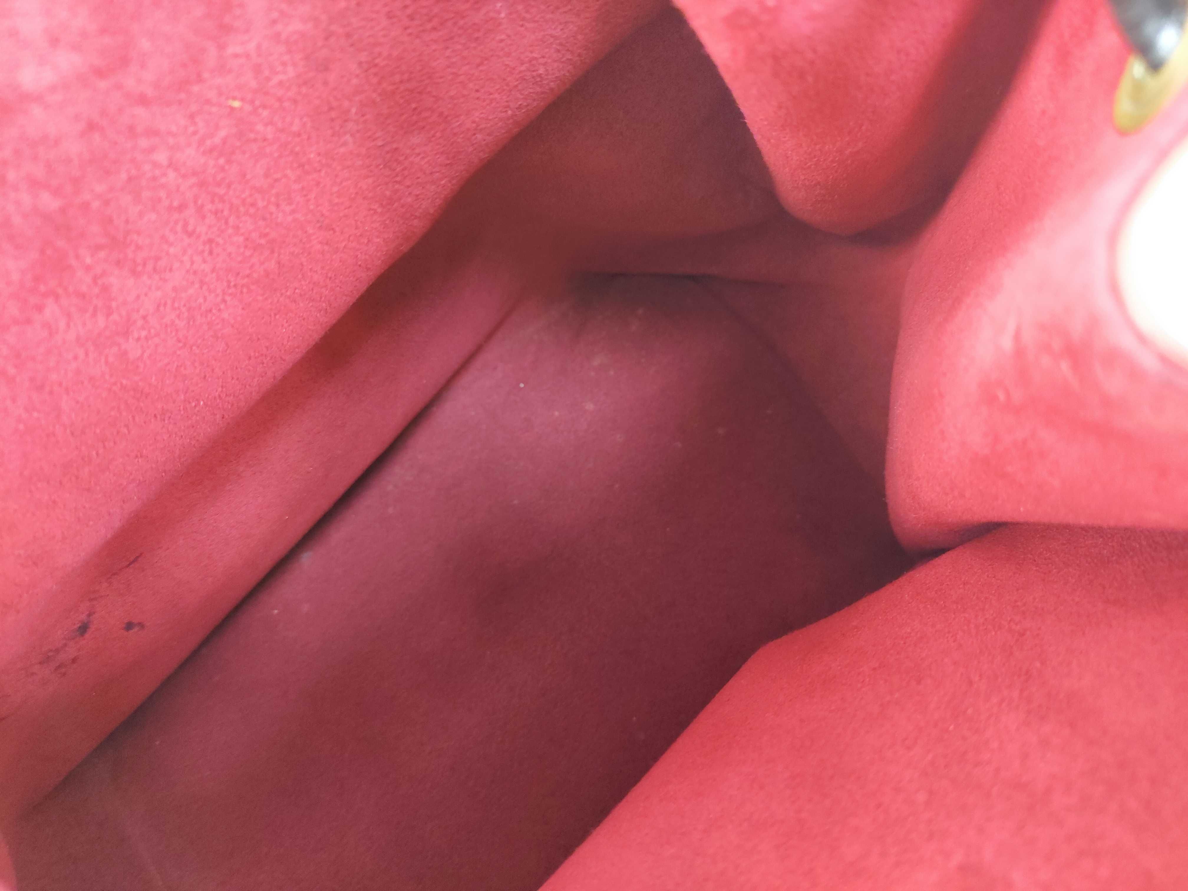 Epi LV Noe Epi — view 11