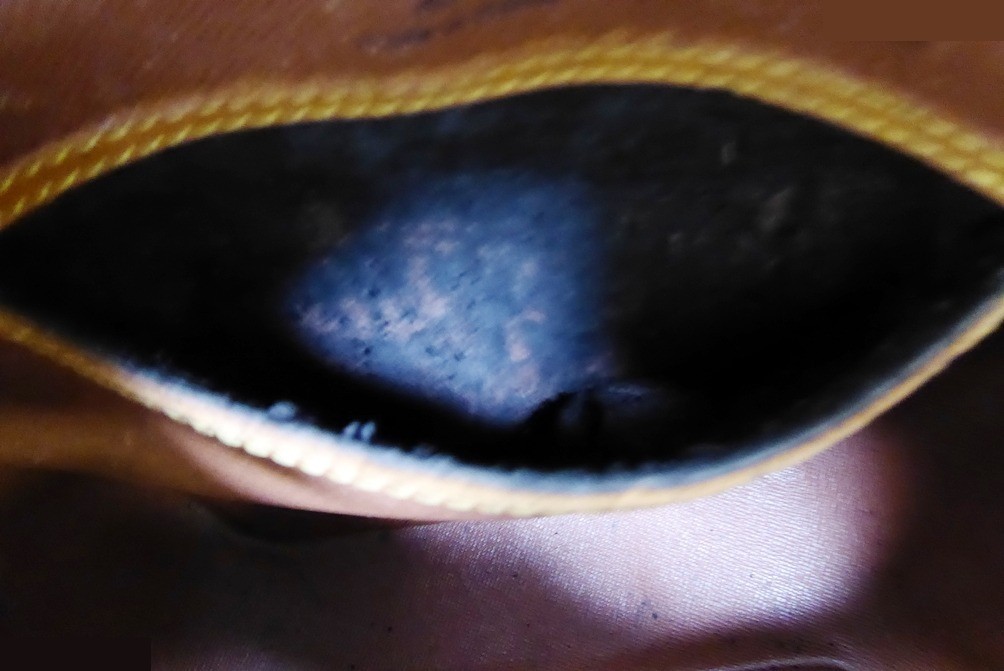 Blower — view 7