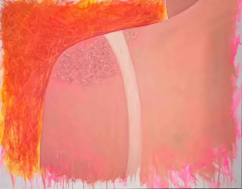 after burn