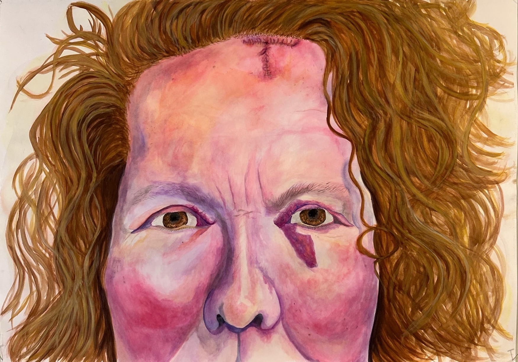 the scars we cannot hide