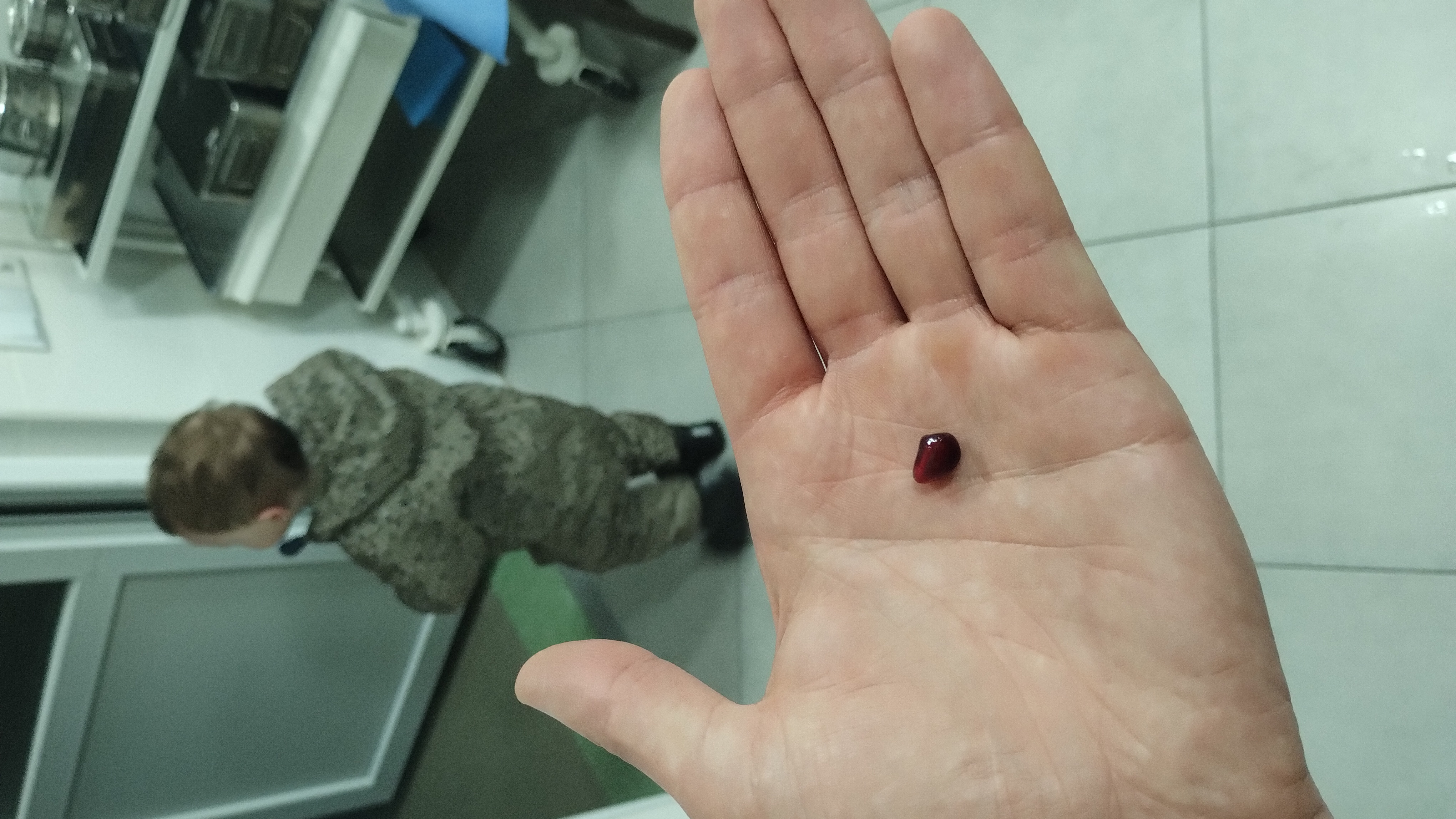 Насінина гранагу тяке було видалено з носового ходу.jpg