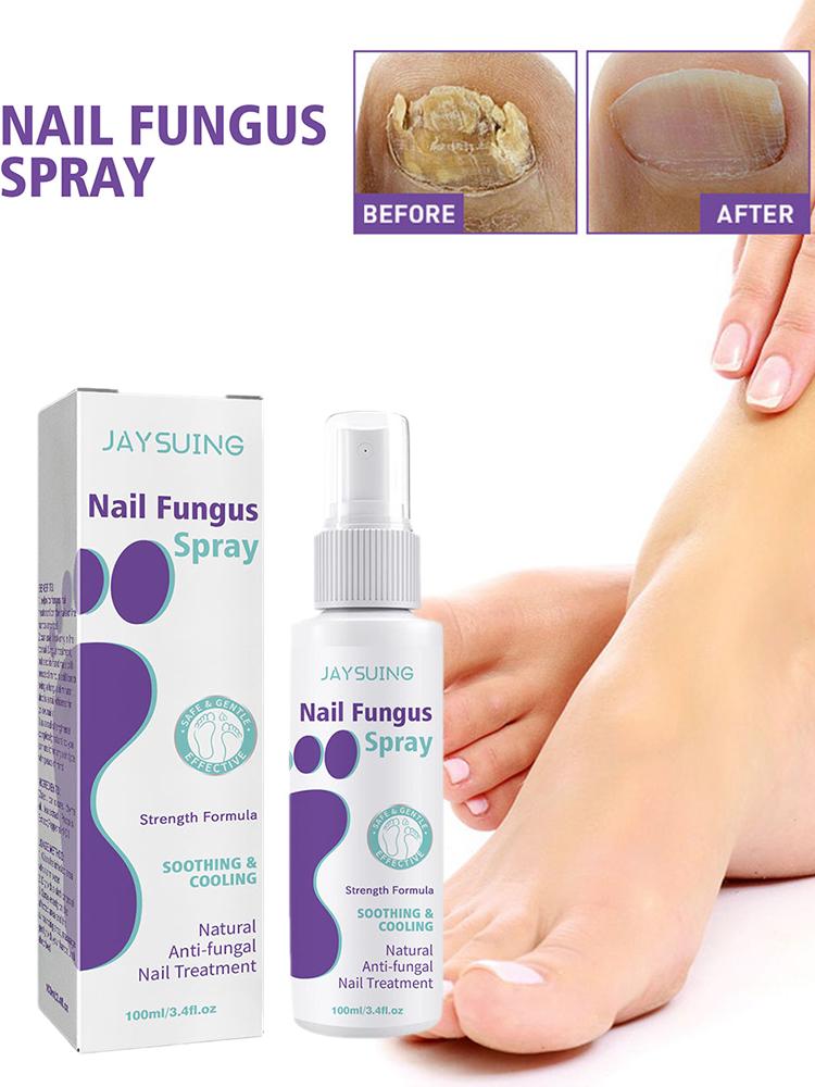 مدينالي رذاذ الفطريات