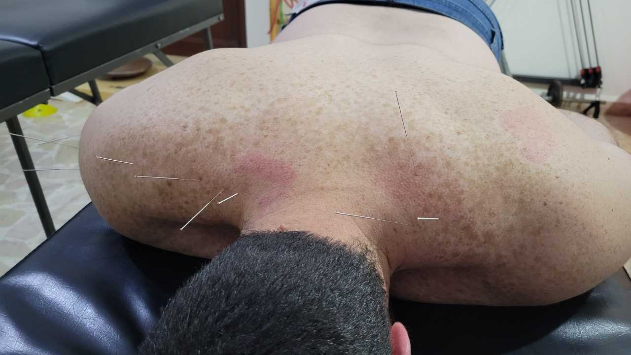 OB physio clinic Physical Therapy Clinic gallery photo 3 serving Beirut District, Lebanon