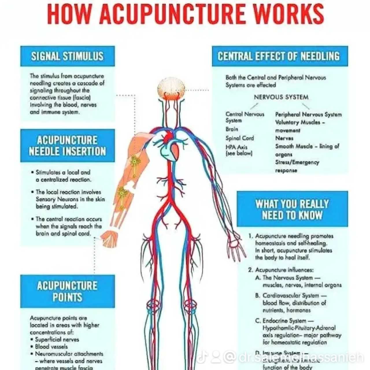 Dr Salem Acupunturist Clinic Acupuncture Clinic gallery photo 9 serving Chouf District, Lebanon