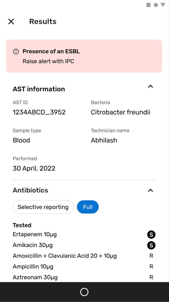 App screenshot: viewing AST results
