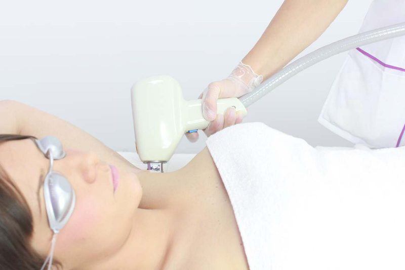 1 Sesion Depilación Laser De 1 De Estas Zonas: Ingles, Axilas, Gluteo · detalle del tratamiento