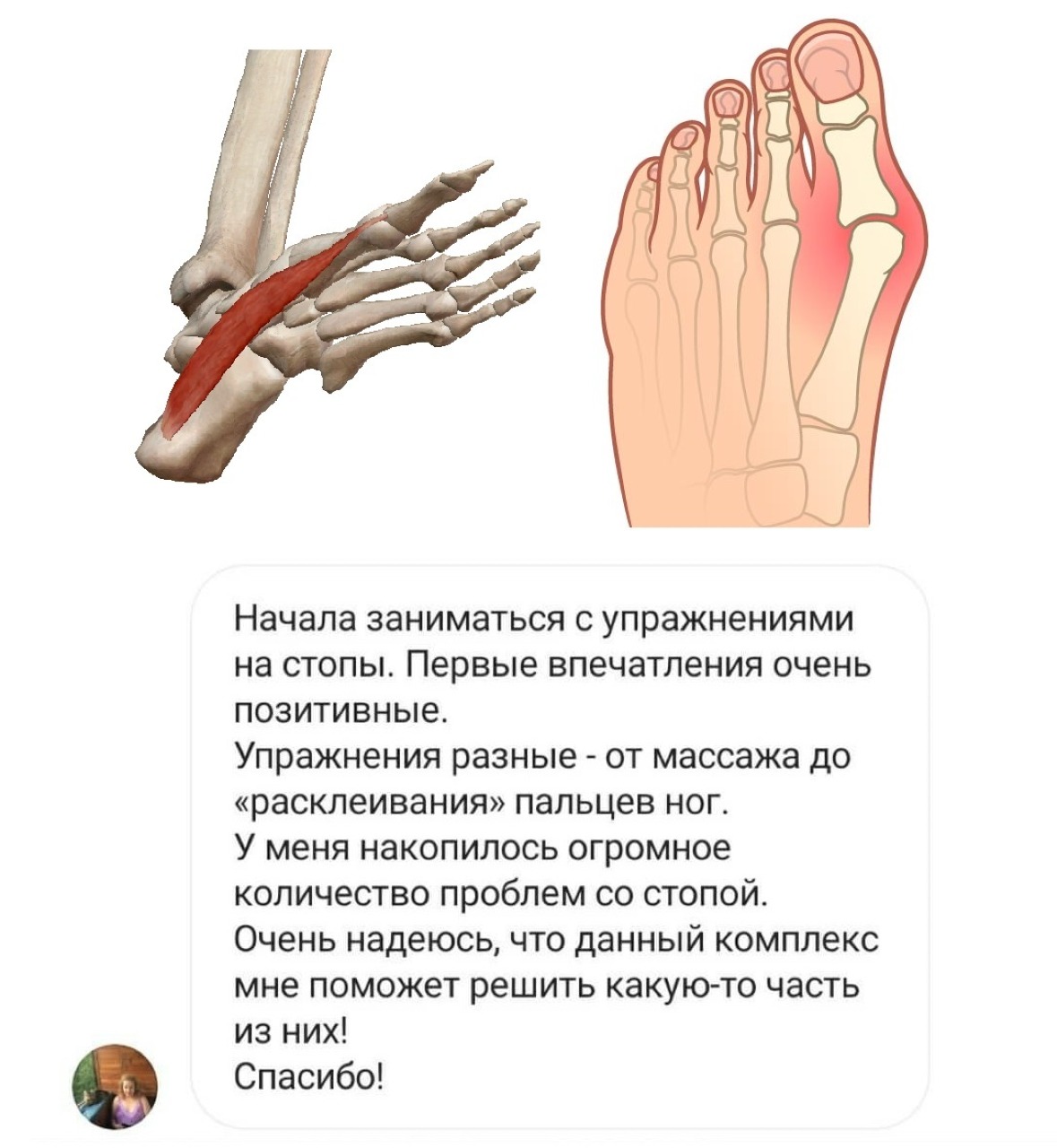 Как выглядит стопа здорового человека
