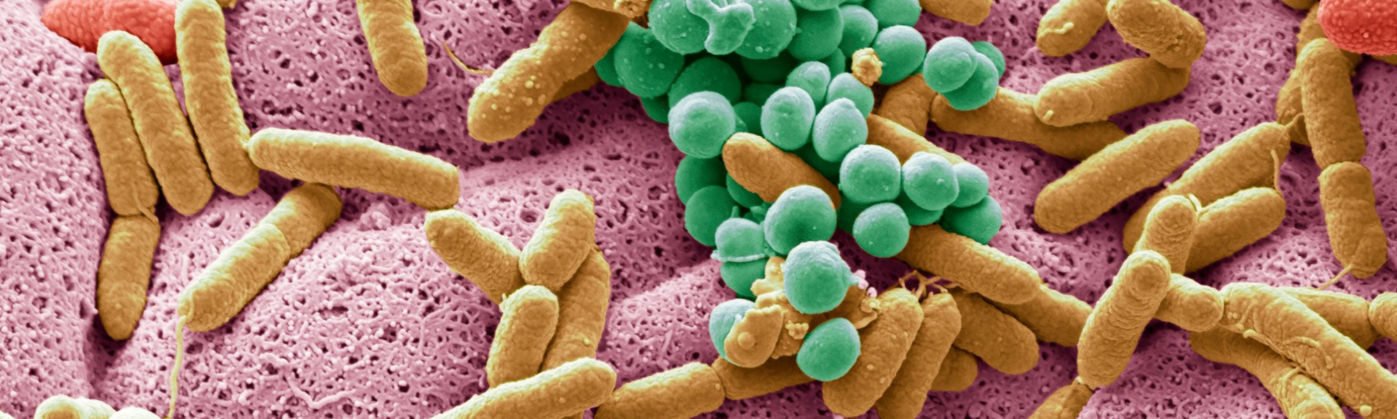 Tus bacterias intestinales también afectan al corazón – Microbiota y riesgo cardiovascular