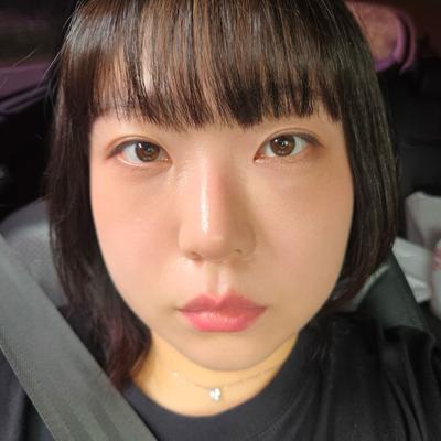눈밑지방 수술 후기, 흉터 없이 다크써클 해결했어요 — 아바성형외과 환자 후기 사진