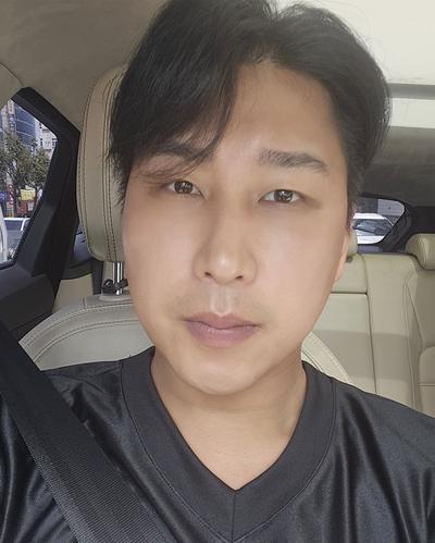 눈밑수술 4주차, 피곤해 보인다는 말 대신 좋아졌대요 — 아바성형외과 환자 후기 사진