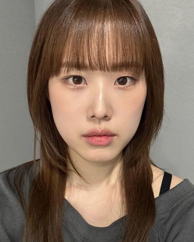 눈밑지방재배치 2주차, 눈밑 환해져서 고민한 게 후회돼요 — 아바성형외과 환자 후기 사진