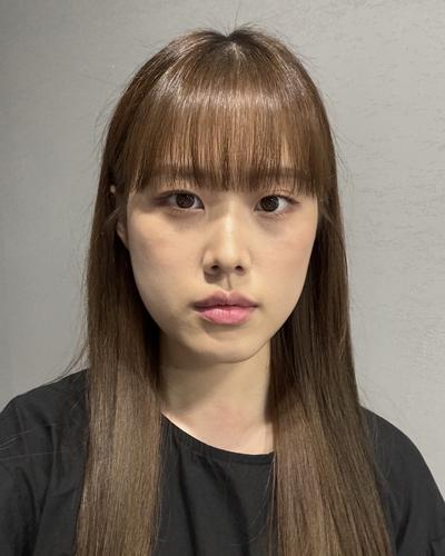 눈밑지방재배치 2주차, 눈밑 환해져서 고민한 게 후회돼요 사진 3 — 아바성형외과 눈밑지방재배치 후기