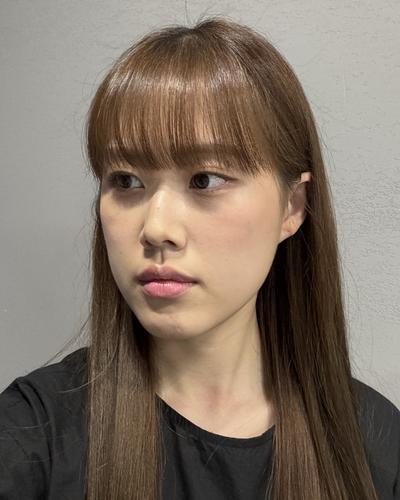 눈밑지방재배치 2주차, 눈밑 환해져서 고민한 게 후회돼요 사진 4 — 아바성형외과 눈밑지방재배치 후기
