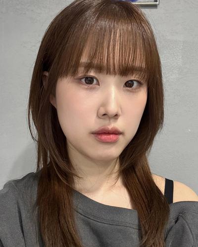 눈밑지방재배치 2주차, 눈밑 환해져서 고민한 게 후회돼요 사진 5 — 아바성형외과 눈밑지방재배치 후기