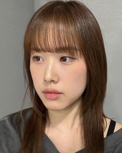 눈밑지방재배치 2주차, 눈밑 환해져서 고민한 게 후회돼요 사진 6 — 아바성형외과 눈밑지방재배치 후기