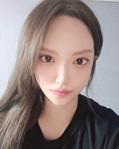 눈성형 환자 후기 — 브라운성형외과 김승수 원장님... (106)