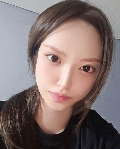 눈밑지방재배치 6주차, 어려보인다는 말 많이 들어요 사진 4 — 아바성형외과 눈밑지방재배치 후기