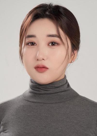 이마 볼륨 수술 수면마취로 끝, 티 안 나게 자연스러워요 사진 3 — 아바성형외과 이마거상 후기