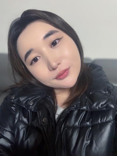 이마 볼륨 수술 수면마취로 끝, 티 안 나게 자연스러워요 사진 4 — 아바성형외과 이마거상 후기