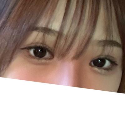 쌍꺼풀 재수술 6주차, 소시지 라인이랑 꼬막눈 다 없어졌어요 사진 4 — 아바성형외과 쌍꺼풀·눈성형 후기