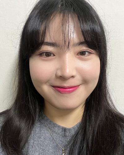 눈밑지방재배치 4주차, 예뻐졌다는 말만 들어요 사진 4 — 아바성형외과 눈밑지방재배치 후기
