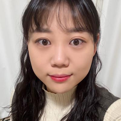 눈밑지방재배치 4주차, 3일차부터 일상생활 가능했어요 — 아바성형외과 환자 후기 사진