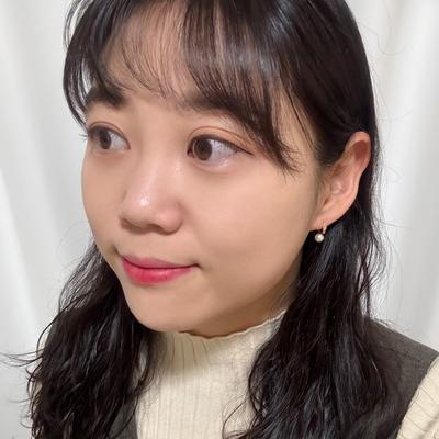 눈밑지방재배치 4주차, 3일차부터 일상생활 가능했어요 사진 4 — 아바성형외과 눈밑지방재배치 후기